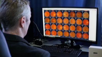 NZ AI can predict retinal and eye diseases